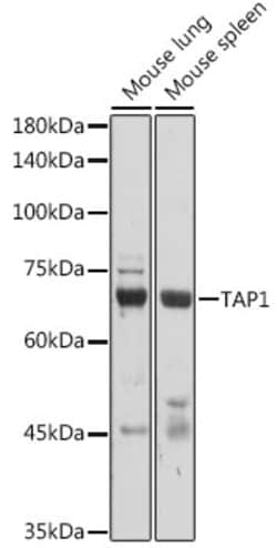 Invitrogen TAP1 Polyclonal Antibody 100 &mu;L; Unconjugated:Antibodies,
