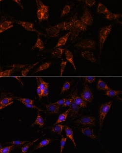 Invitrogen TBCC Polyclonal Antibody 100 μL; Unconjugated:Antibodies,