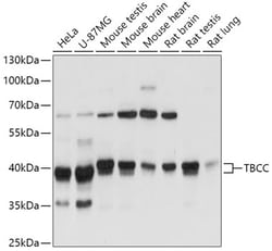 Invitrogen TBCC Polyclonal Antibody 100 μL; Unconjugated:Antibodies,