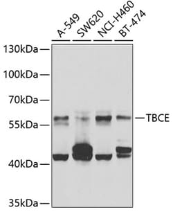 Invitrogen TBCE Polyclonal Antibody 100 &mu;L; Unconjugated:Antibodies,