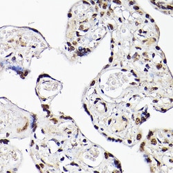 TBX20 Polyclonal Antibody:Antibodies, Polyclonal