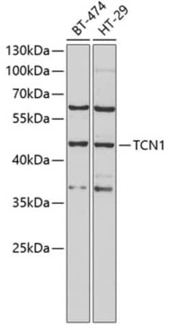 Invitrogen TCN1 Polyclonal Antibody 100 μL; Unconjugated:Antibodies,
