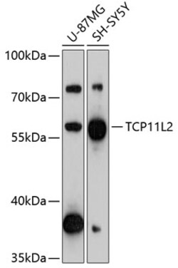 Invitrogen TCP11L2 Polyclonal Antibody 100 &mu;L; Unconjugated:Antibodies,