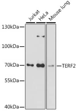 Invitrogen TERF2 Polyclonal Antibody 100 &mu;L; Unconjugated:Antibodies,