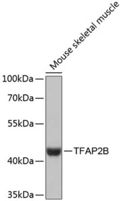 Invitrogen TFAP2B Polyclonal Antibody 100 &mu;L; Unconjugated:Antibodies,