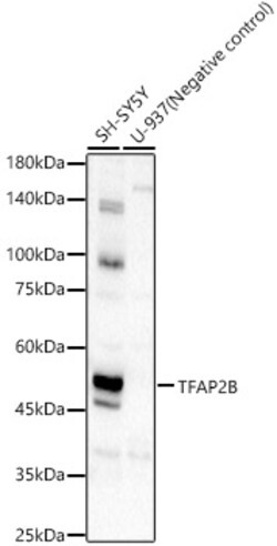 Invitrogen TFAP2B Polyclonal Antibody 100 &mu;L; Unconjugated:Antibodies,