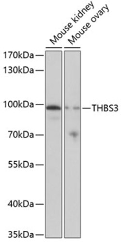 Invitrogen Thrombospondin 3 Polyclonal Antibody 100 &mu;L; Unconjugated:Antibodies,