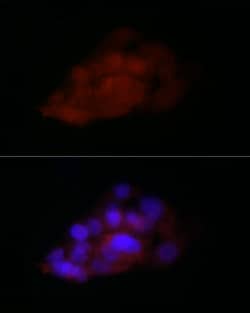 Invitrogen TIA-1 Polyclonal Antibody 100 &mu;L; Unconjugated:Antibodies,
