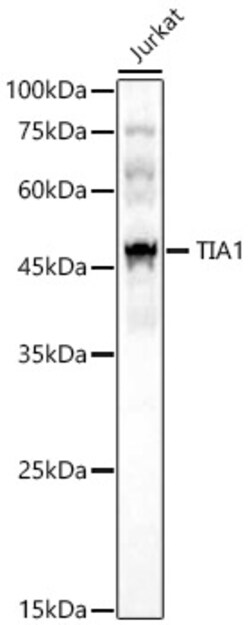 Invitrogen TIA-1 Polyclonal Antibody 100 &mu;L; Unconjugated:Antibodies,