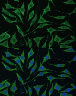Invitrogen TIMM8B Polyclonal Antibody 100 &mu;L; Unconjugated:Antibodies,