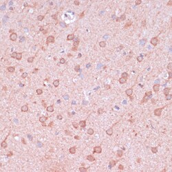 Invitrogen TIMM8B Polyclonal Antibody 100 &mu;L; Unconjugated:Antibodies,