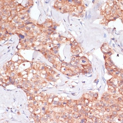 Invitrogen TIMM8B Polyclonal Antibody 100 &mu;L; Unconjugated:Antibodies,