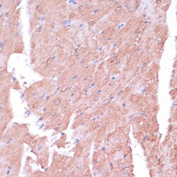 Invitrogen TIMM8B Polyclonal Antibody 100 &mu;L; Unconjugated:Antibodies,