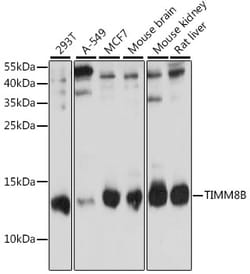 Invitrogen TIMM8B Polyclonal Antibody 100 &mu;L; Unconjugated:Antibodies,