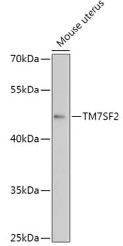 Invitrogen TM7SF2 Polyclonal Antibody 100 &mu;L; Unconjugated:Antibodies,