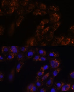 Invitrogen TMED3 Polyclonal Antibody 100 &mu;L; Unconjugated:Antibodies,