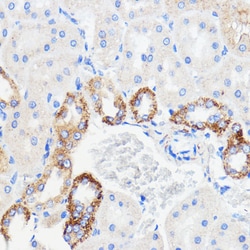 Invitrogen TMED3 Polyclonal Antibody 100 &mu;L; Unconjugated:Antibodies,