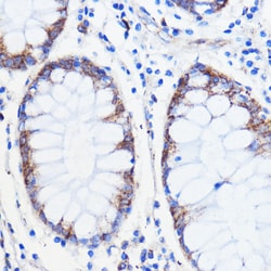 Invitrogen TMED3 Polyclonal Antibody 100 &mu;L; Unconjugated:Antibodies,