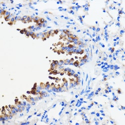 Invitrogen TMED3 Polyclonal Antibody 100 &mu;L; Unconjugated:Antibodies,