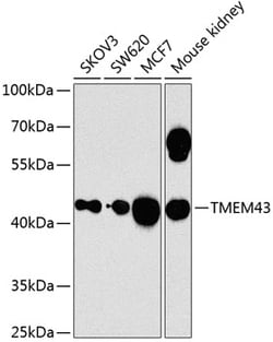 Invitrogen TMEM43 Polyclonal Antibody 100 &mu;L | Buy Online | Invitrogen&trade; | Fisher Scientific
