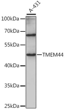 Invitrogen TMEM44 Polyclonal Antibody 100 &mu;L; Unconjugated:Antibodies,