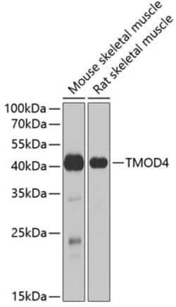 Invitrogen TMOD4 Polyclonal Antibody 100 &mu;L; Unconjugated:Antibodies,