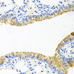 Invitrogen TOB2 Polyclonal Antibody 100 &mu;L; Unconjugated:Antibodies,
