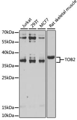 Invitrogen TOB2 Polyclonal Antibody 100 &mu;L; Unconjugated:Antibodies,