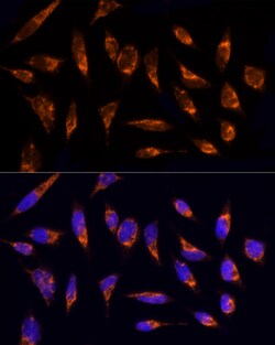 Invitrogen TOM20 Polyclonal Antibody 100 &mu;L; Unconjugated:Antibodies,
