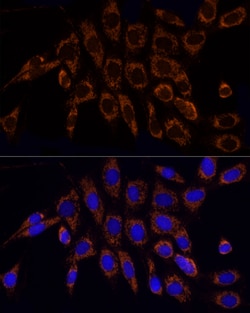 Invitrogen TOM20 Polyclonal Antibody 100 &mu;L; Unconjugated:Antibodies,