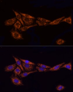 Invitrogen TOM20 Polyclonal Antibody 100 &mu;L; Unconjugated:Antibodies,