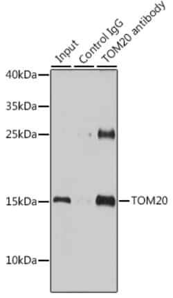 Invitrogen TOM20 Polyclonal Antibody 100 &mu;L; Unconjugated:Antibodies,