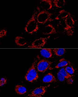 Invitrogen TOMM40 Polyclonal Antibody 100 &mu;L; Unconjugated:Antibodies,