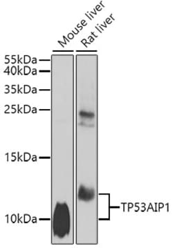 Invitrogen p53AIP1 Polyclonal Antibody 100 &mu;L; Unconjugated:Antibodies,