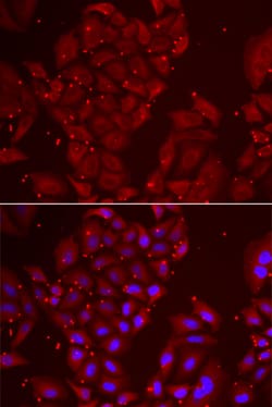Invitrogen TPP2 Polyclonal Antibody 100 &mu;L; Unconjugated:Antibodies,
