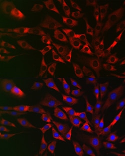 Invitrogen TRAF3IP2 Polyclonal Antibody 100 &mu;L; Unconjugated:Antibodies,