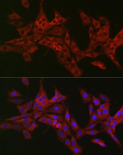 Invitrogen TRAF3IP2 Polyclonal Antibody 100 &mu;L; Unconjugated:Antibodies,