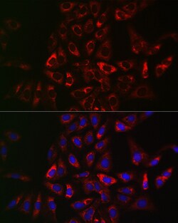 Invitrogen TRAF3IP2 Polyclonal Antibody 100 &mu;L; Unconjugated:Antibodies,