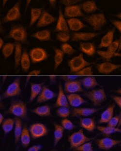 Invitrogen TRIM16 Polyclonal Antibody 100 &mu;L; Unconjugated:Antibodies,