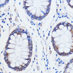 Invitrogen TRIM16 Polyclonal Antibody 100 &mu;L; Unconjugated:Antibodies,