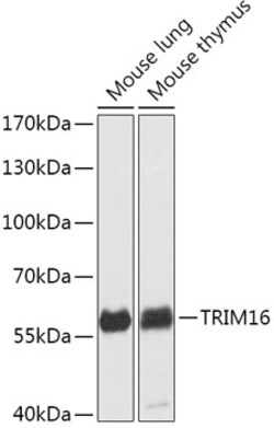 Invitrogen TRIM16 Polyclonal Antibody 100 &mu;L; Unconjugated:Antibodies,