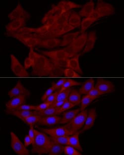 Invitrogen TRIM21 Polyclonal Antibody 100 &mu;L; Unconjugated:Antibodies,