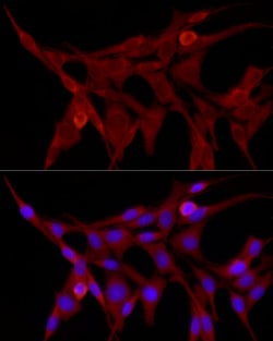 Invitrogen TRIM21 Polyclonal Antibody 100 &mu;L; Unconjugated:Antibodies,