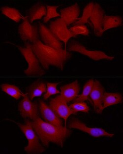 Invitrogen TRIM21 Polyclonal Antibody 100 &mu;L; Unconjugated:Antibodies,