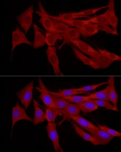 Invitrogen TRIM21 Polyclonal Antibody 100 &mu;L; Unconjugated:Antibodies,