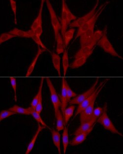 Invitrogen TRIM21 Polyclonal Antibody 100 &mu;L; Unconjugated:Antibodies,