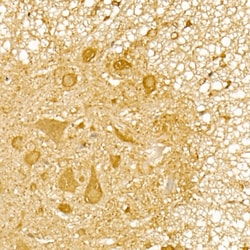 Invitrogen TRIM21 Polyclonal Antibody 100 &mu;L; Unconjugated:Antibodies,