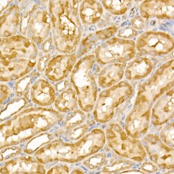 Invitrogen TRIM21 Polyclonal Antibody 100 &mu;L; Unconjugated:Antibodies,