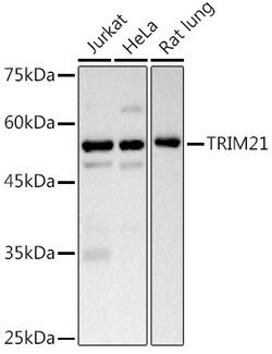 Invitrogen TRIM21 Polyclonal Antibody 100 &mu;L; Unconjugated:Antibodies,