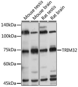 Invitrogen TRIM32 Polyclonal Antibody 100 μL; Unconjugated:Antibodies,